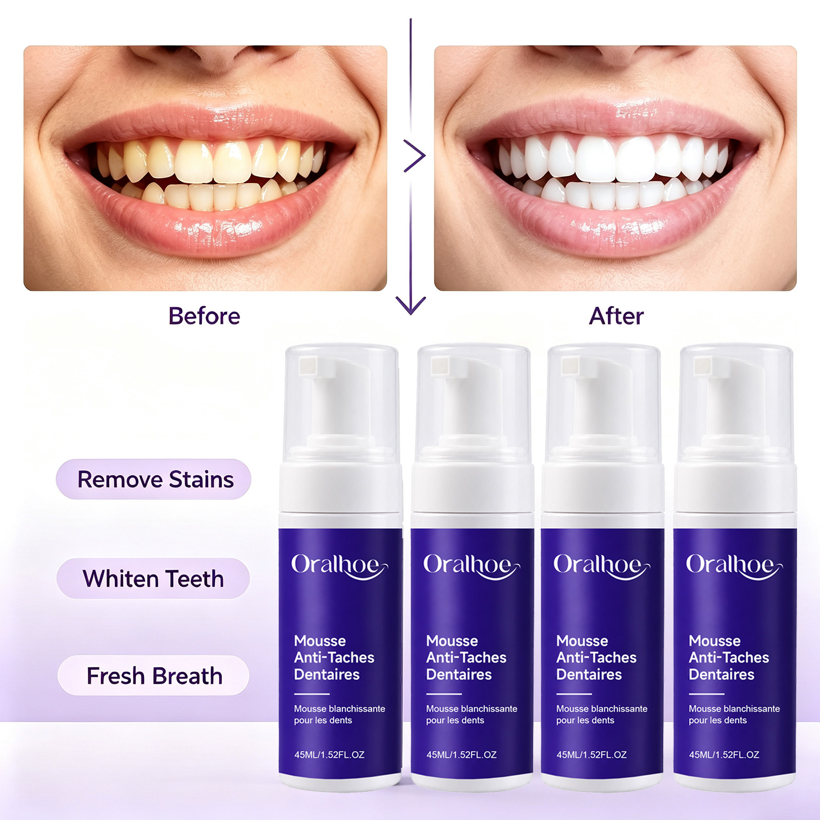 Teeth Whitening Routine - Lila schäumende Zahnaufhellungs-Zahnpasta, schmelzschutzfreundlicher Perlweiß-Schaum zur