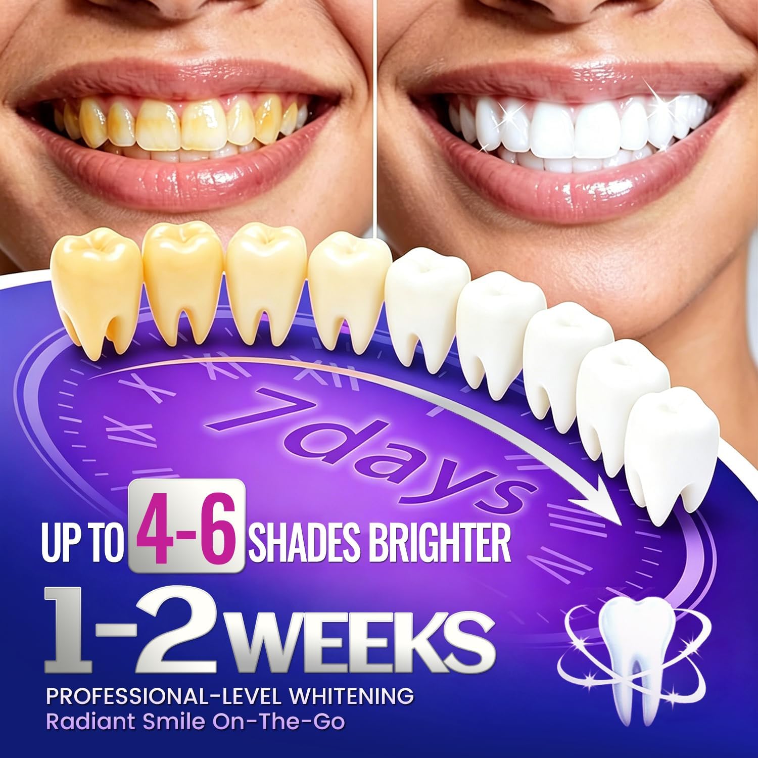 7 Paar Zahnaufhellungsstreifen – Teeth Whitening Street Bewertung und Preis
