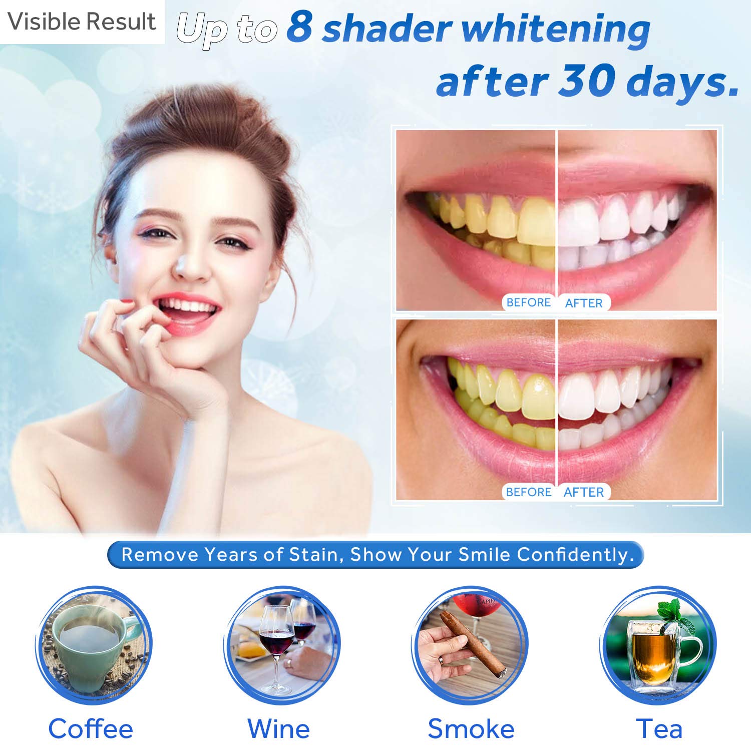 Zahnaufhellungsgel, Nachfüllsp – Teeth Whitening Doctor Bewertung und Preis