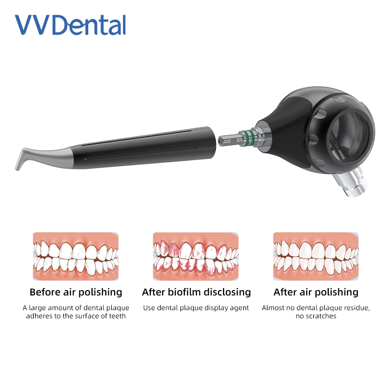 VVDental Air Polisher Jet Air  – Colgate Whitening Teeth Bewertung und Preis
