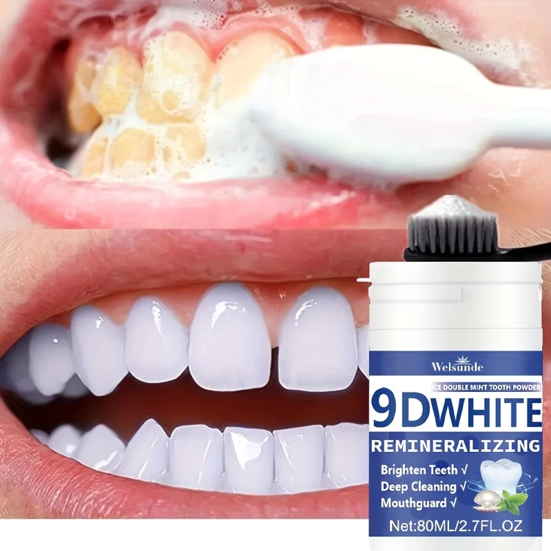 9D Weißes Remineralisierendes  – Teeth Whitening Street Bewertung und Preis