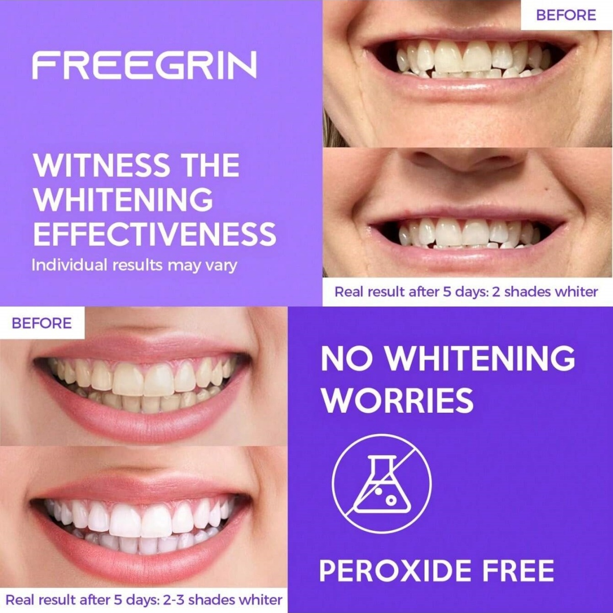 Deluxe Zahnaufhellungsaufklebe – Teeth Whitening Doctor Bewertung und Preis